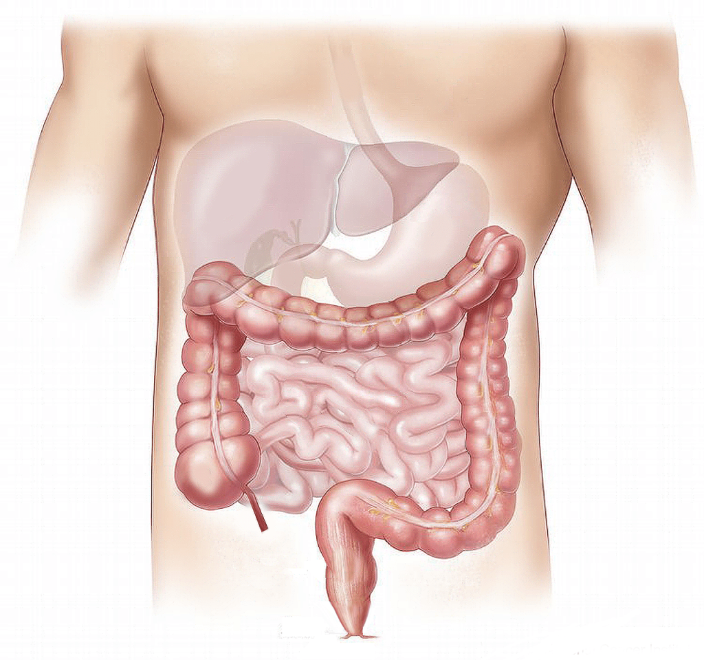 Colon irritable
