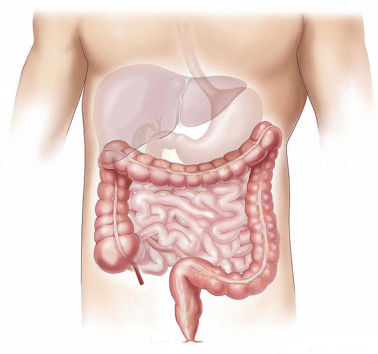 Colon irritable